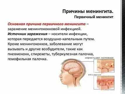 Герпесный менингит. Энтеровирусный менингит у детей. Герпесный менингит. Серозный менингит вирусной этиологии. Минингитовая инфекция симптомы у детей.