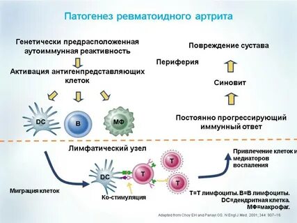 Ревматоидный артрит иммунный