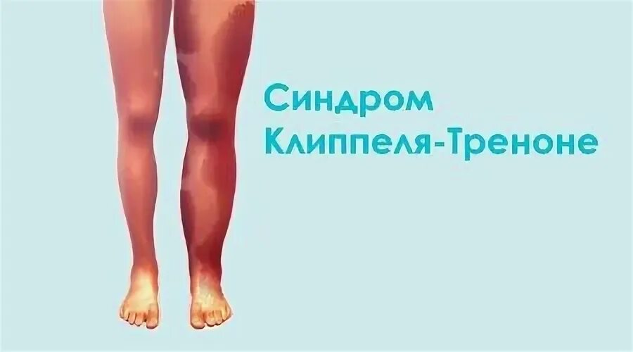 Паркс вебера рубашова
