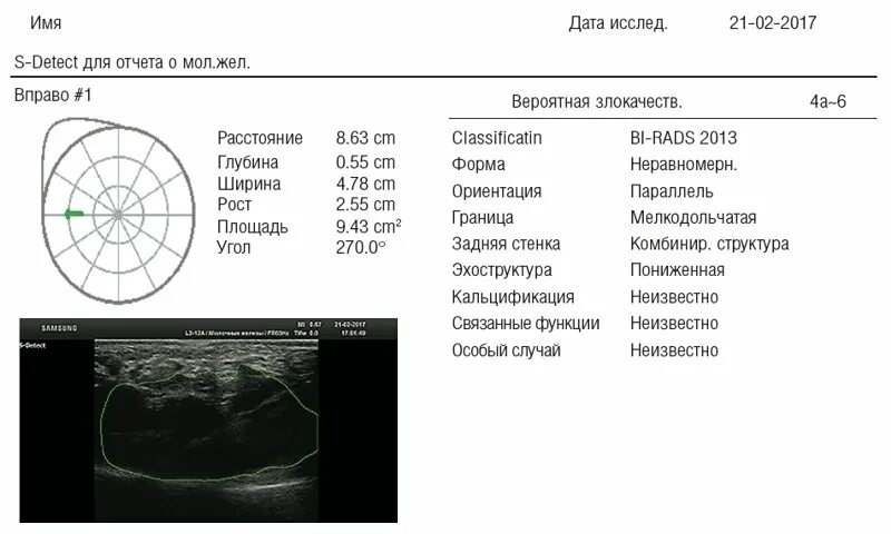 Могилев узи молочных могилев. Протокол узи молочных желез образец. узи молочной железы протокол исследования. узи молочных желез протокол описания норма. протокол узи молочных желез заболотская.