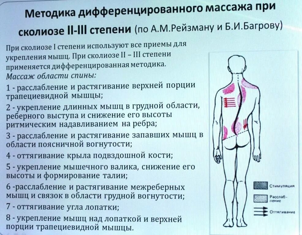 Массаж при s образном сколиозе. Массаж при сколиозе позвоночника. методика массажа при сколиозе. массаж спины при сколиозе. массаж при сколиозе 2 степени.