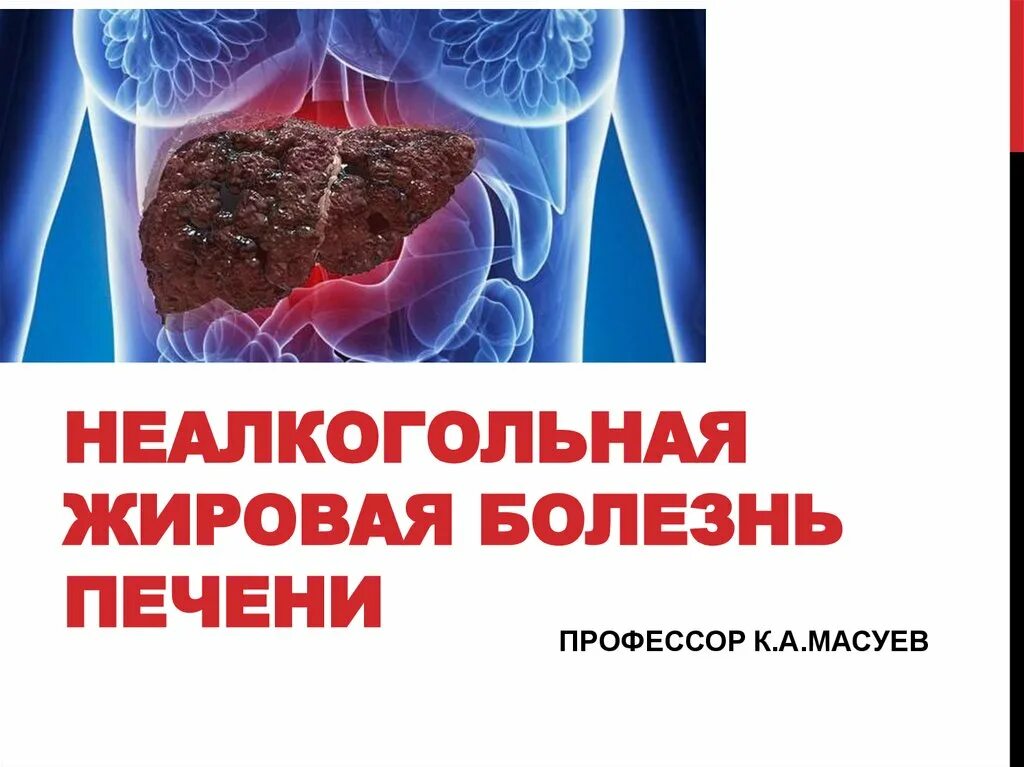 Группы заболевания печени. Жировая болезнь печени. Неалкогольная жировая болезнь печени. Болезни печени презентация.