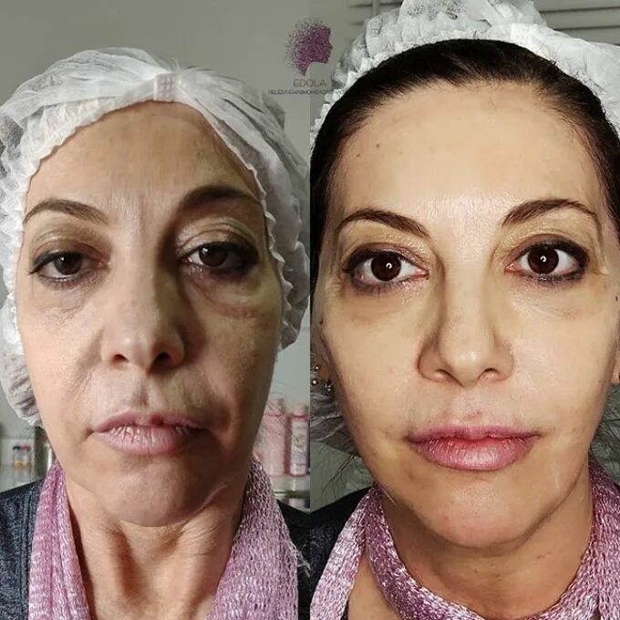 Ботакс