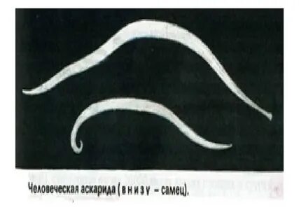 Аскарида двусторонняя симметрия тела
