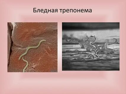 Спирохета это