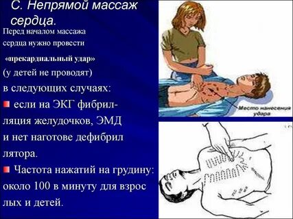 Темп непрямого массажа сердца в минуту