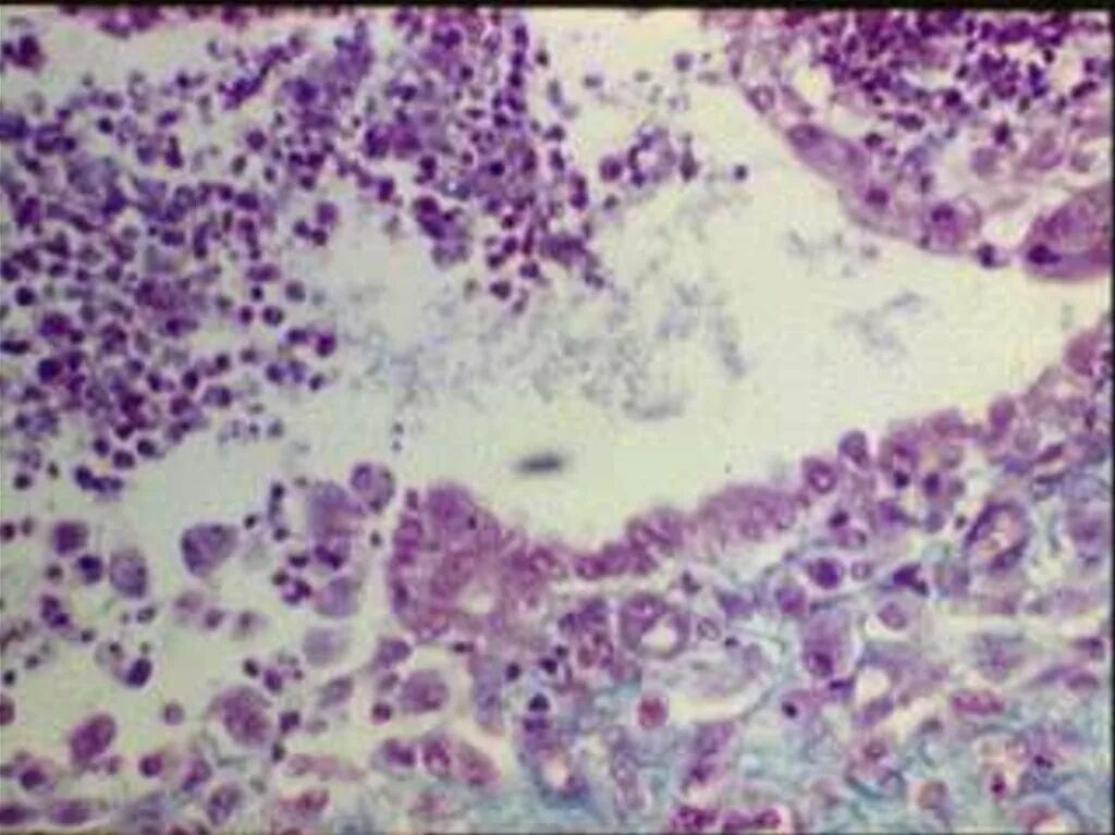 Brucella spp. Brucella abortus микроскопия. бруцеллез бактерия. бруцелла бактерия бруцеллез.
