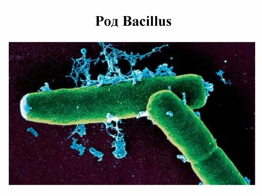 Сибирская язва возбудитель бактерия. Bacillus anthracis Сибирская язва. Бациллус антрацис возбудитель.