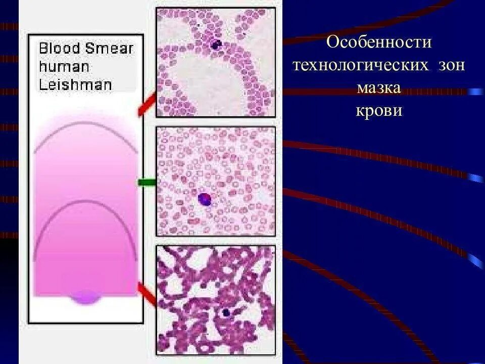 Хламидии пневмонии. Chlamydophila pneumoniae эпидемиология. Кровь на хламидии и микоплазму