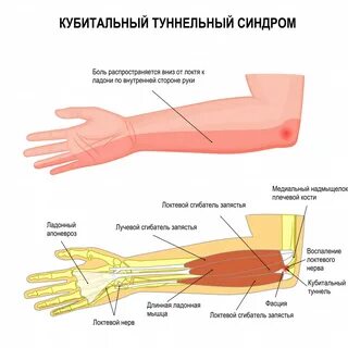 Ноет рука от локтя до кисти после нагрузки 58 фото - wForm.ru