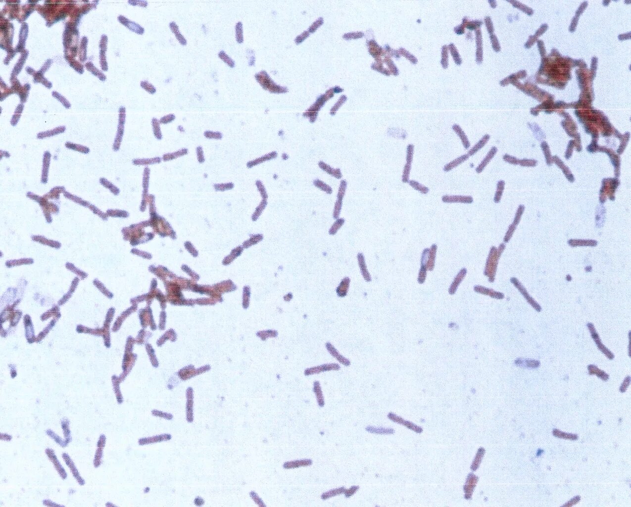 Бациллы цереус bacillus cereus. Бактерии палочки под микроскопом. Brevibacillus laterosporus. Bacillus subtilis грамположительные. Споры бактерий bacillus cereus.