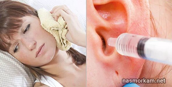 Заложенность носа и заложенность ушей. Что делать если заложило ухо. Заложило уши при простуде. Заложенность ушей при насморке.