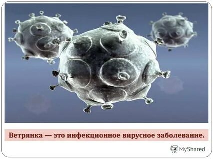 Вирус ветрянки