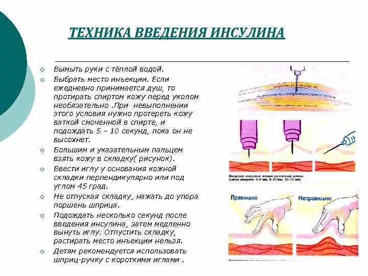 Инъекция инсулина алгоритм