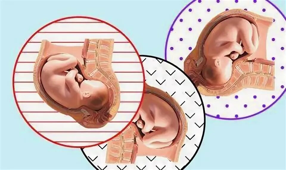 Малыш в животике у мамы. Младенец в утробе икает. Может ли ребенок икать в утробе. Может ли ребенок икать в утробе. Причины икания малыша в утробе.