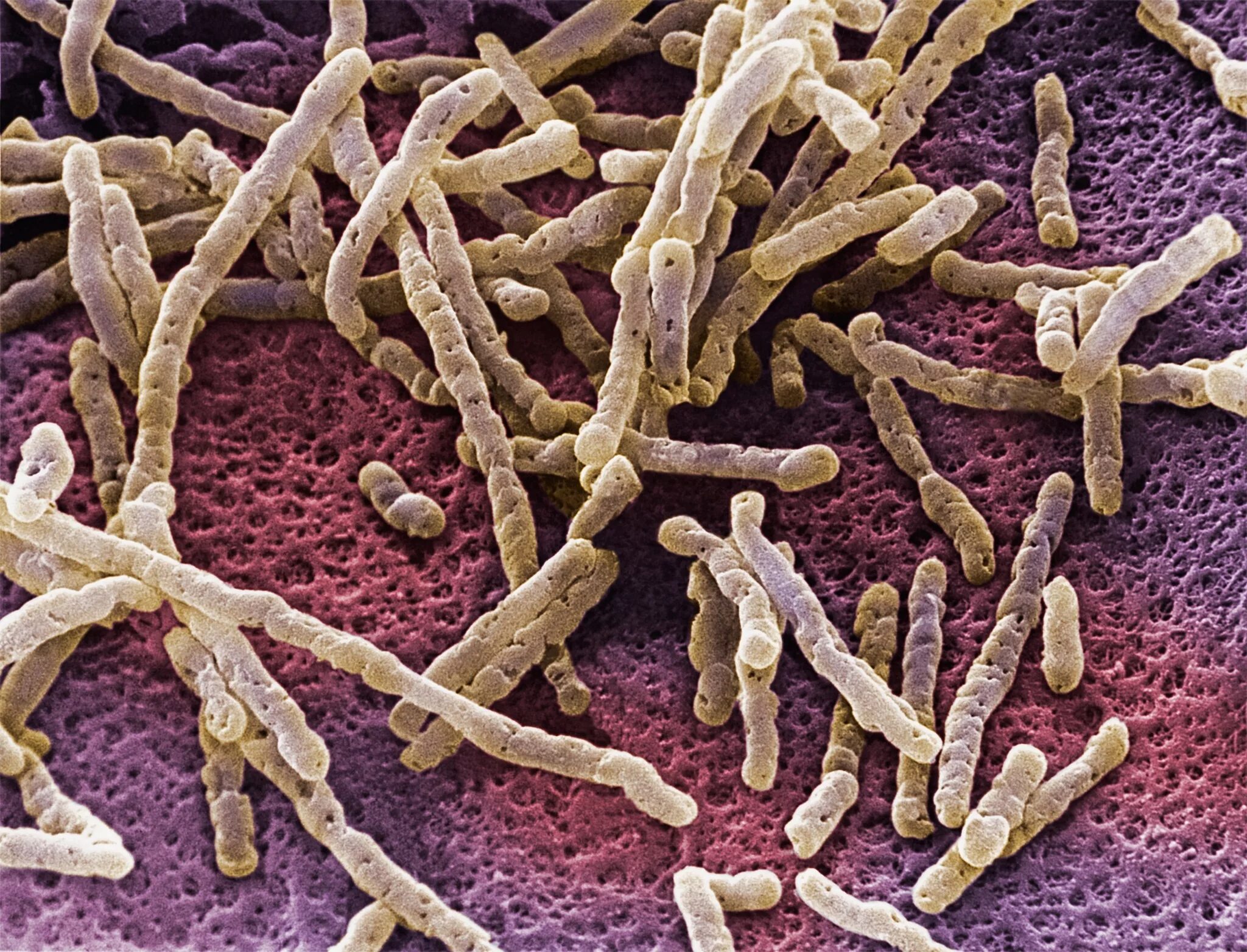 Бактерия кандида. Грибы микроорганизмы кандиды. кандида микодерма. candida mycoderma дрожжи. клостридия диффициле под микроскопом.