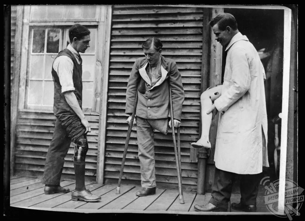 Инвалиды во время войны. Ампутант первой мировой войны. Протезы первой мировой войны. Протезы ног первой мировой войны.