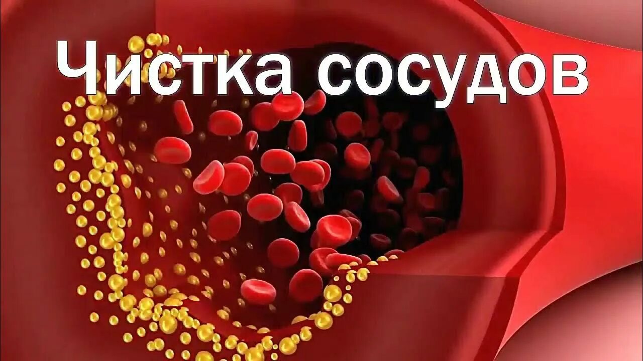 Прочистка сосудов. Кардиолог очистка сосудов. Очищение сосудов Мясников. Лекарство для очистки сосудов от Мясникова.