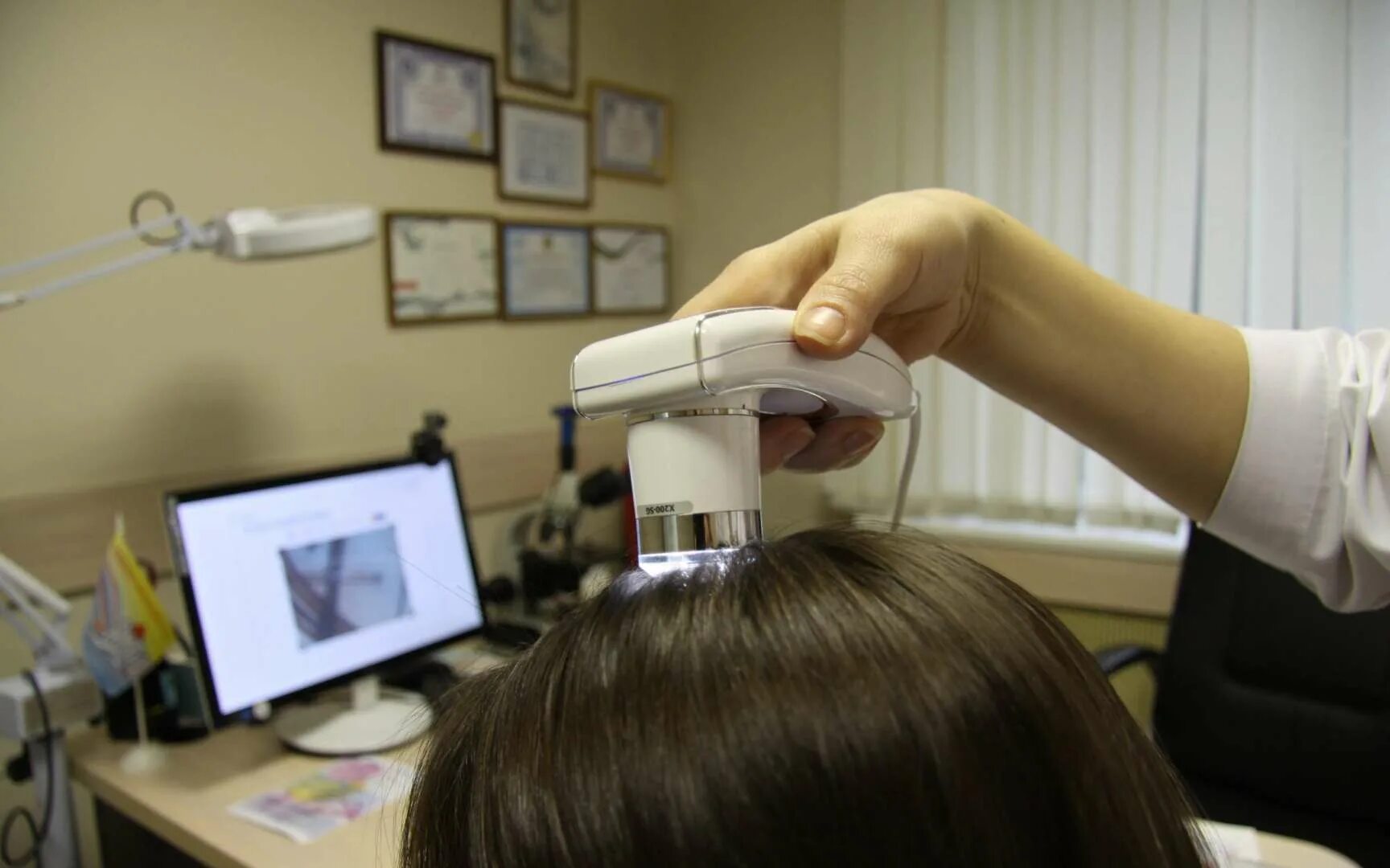 Трихоскопия волос. Пилинг кожи головы АМД лаборатория. Аппарат для диагностики волос и кожи головы. Трихоскопия с ультрафиолетом.