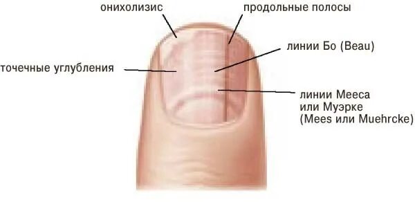 Что значит ногтях