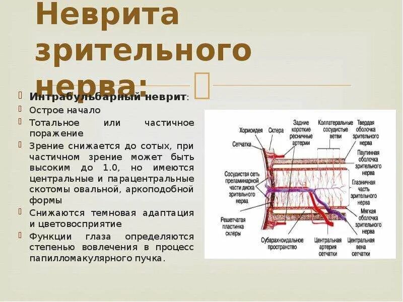 Неврит зрительного нерва мкб. Неврит зрительного неврита. интрабульбарный неврит зрительного нерва. неврит зрительного нерва признаки.