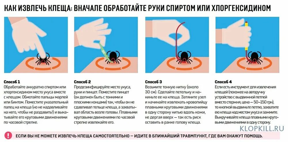 Покажите место укуса нужно срочно отсосать яд. Как правильно удалить клеща с тела человека в домашних условиях. Как правильно извлечь клеща. Вытащить клеща у человека в домашних условиях правильно. Как достать клеща у собаки.