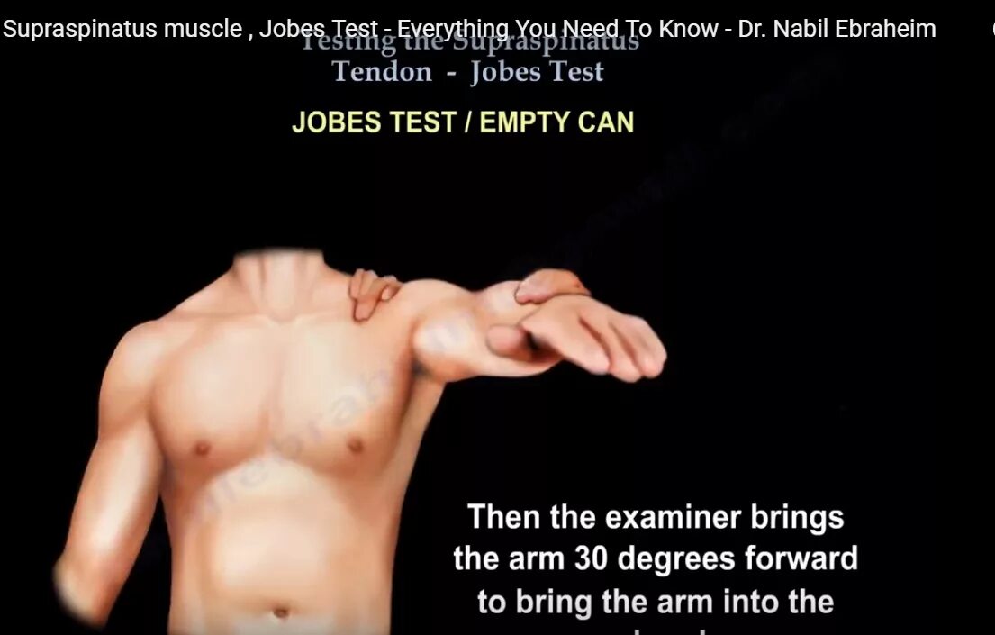 Empty test. Тест jobe. empty can test. jobe тест характеризует. appley тест плеча.