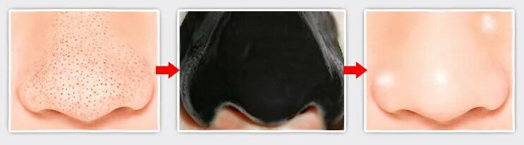 Маленькие черные точки на носу. На нос 5 точек на. На нос 5 точек на. На нос 5 точек на. Что то черное.