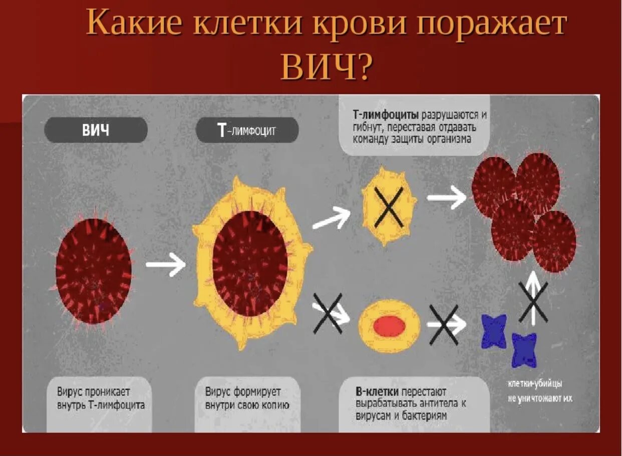 Спид организм. Стадии патогенеза ВИЧ инфекции. Патогенез ВИЧ инфекции схема. Патогенез ВИЧ вируса схема. Синдром приобретенного иммунодефицита патогенез.