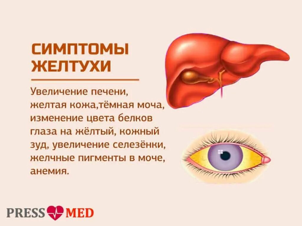 Гепатит а последствия. Признаки проявления желтухи. Болезнь печени желтуха.