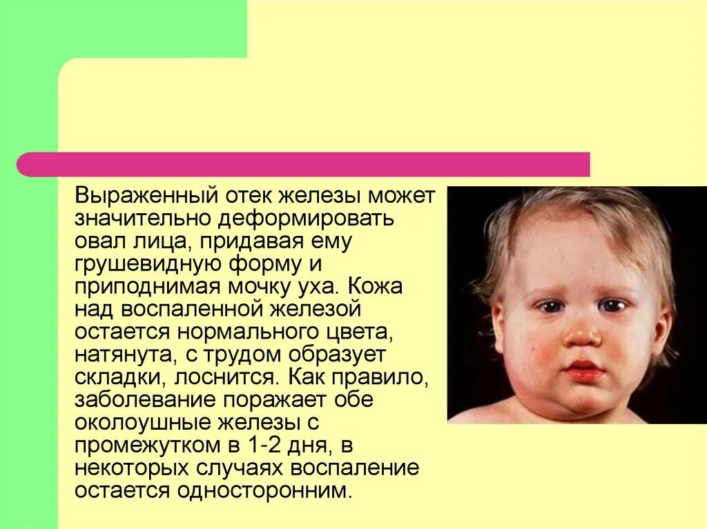 Паротит когда делают. Свинка эпидемический паротит. Свинка паротит презентация. Эпидемический паротит презентация.