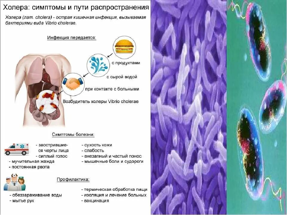 Холера где. Холера возбудитель симптомы профилактика. Презентация на тему холера.