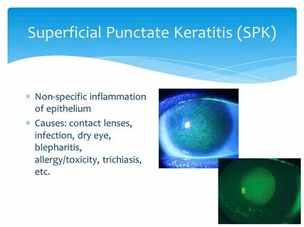 Blepharitis латынь