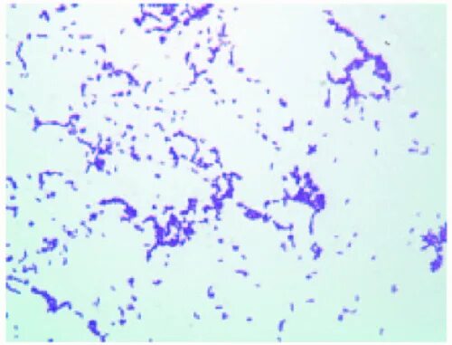 Mobiluncus spp corynebacterium в мазке. Коринебактерии дифтерии микробиология. corynebacterium glutamicum мазок. коринебактерии под микроскопом метиленовый синий. лактобактерии окрашенные метиленовым синим.