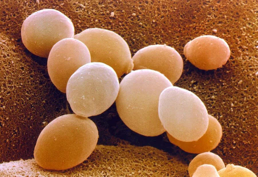 Есть гриб дрожжи. Дрожжи рода Saccharomyces cerevisiae.. Пекарские дрожжи Saccharomyces cerevisiae. Одноклеточные дрожжи Saccharomyces cerevisiae. Saccharomyces cerevisiae Курские дрожжи.