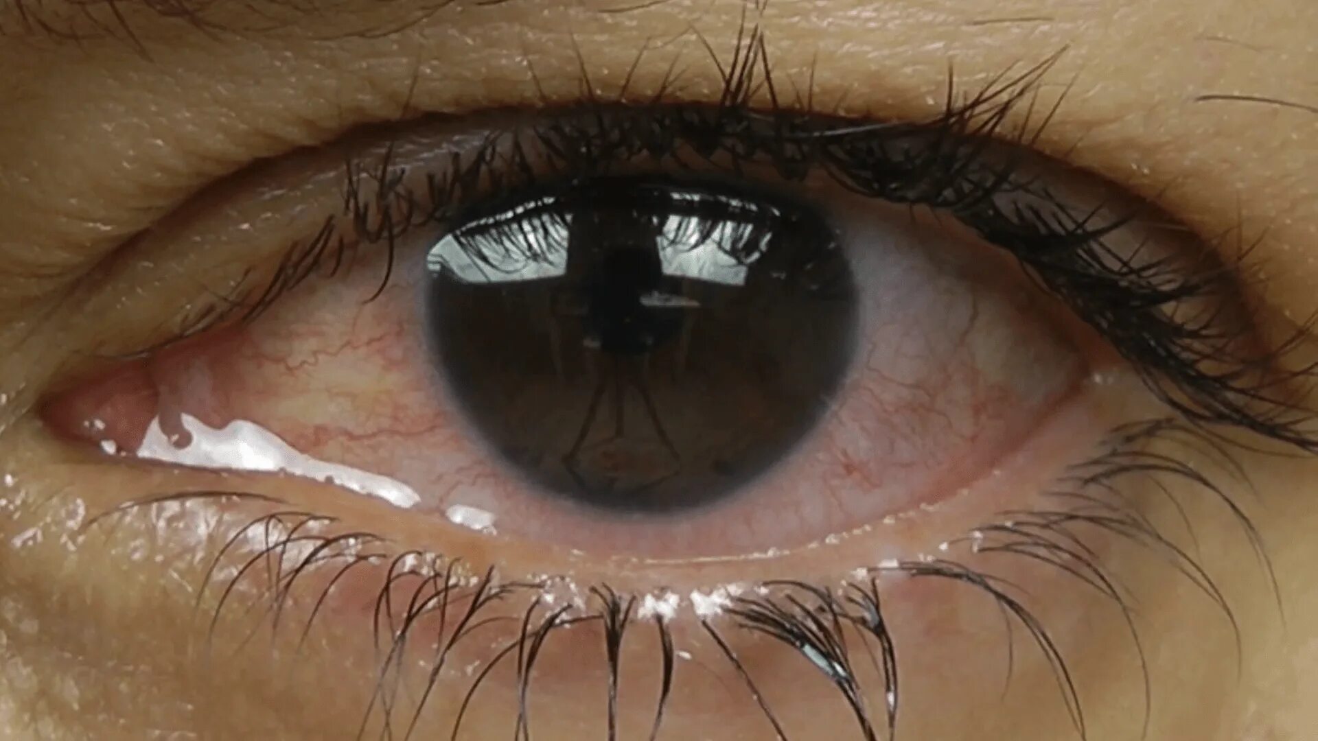 Tear after tear