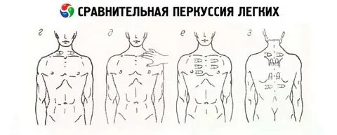 Перкуссия органов дыхания