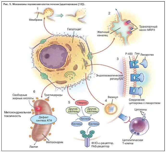Повреждение клеток печени. Печеночная клетка гепатоцит. Печеночные клетки гепатоциты. Цитолиз гепатоцитов. Цитолиз клеток печени.