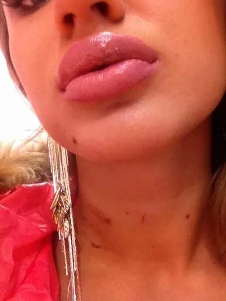 Лицо для макияжа. Губы вали карнавал до и после пластики. Val. Губы вали карнавал до и после пластики. Карнавал губы.