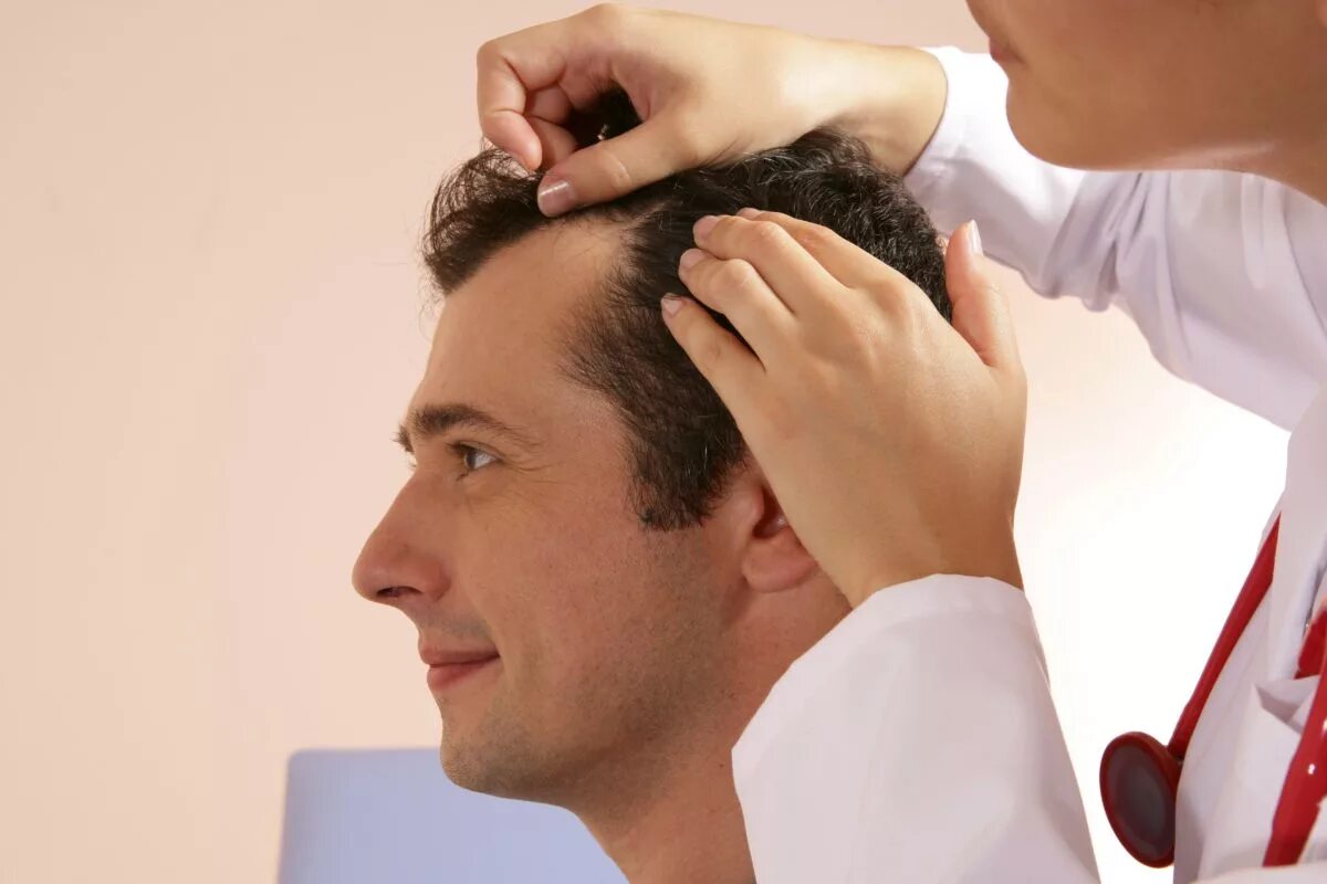 Укрепление волос мужчинам. Выпадение волос у мужчин. Консультация трихолога. Проблемы с волосами.