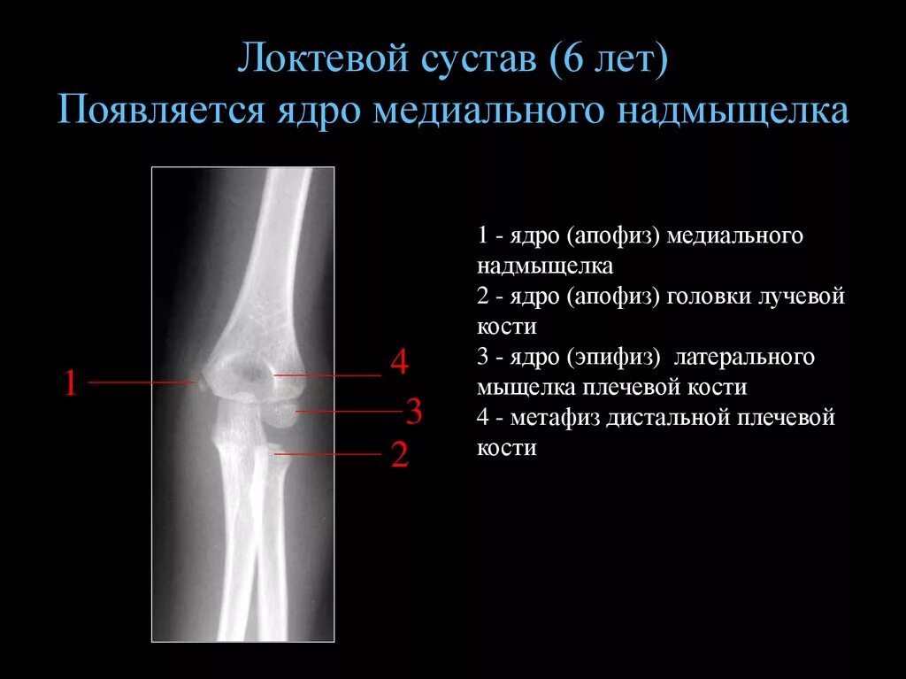 Локтевой сустав анатомия кость. Локтевой сустав рентген 8 лет норма. Локтевой сустав строение анатомия костей. Рентген локтевой сустав 6 лет норма.