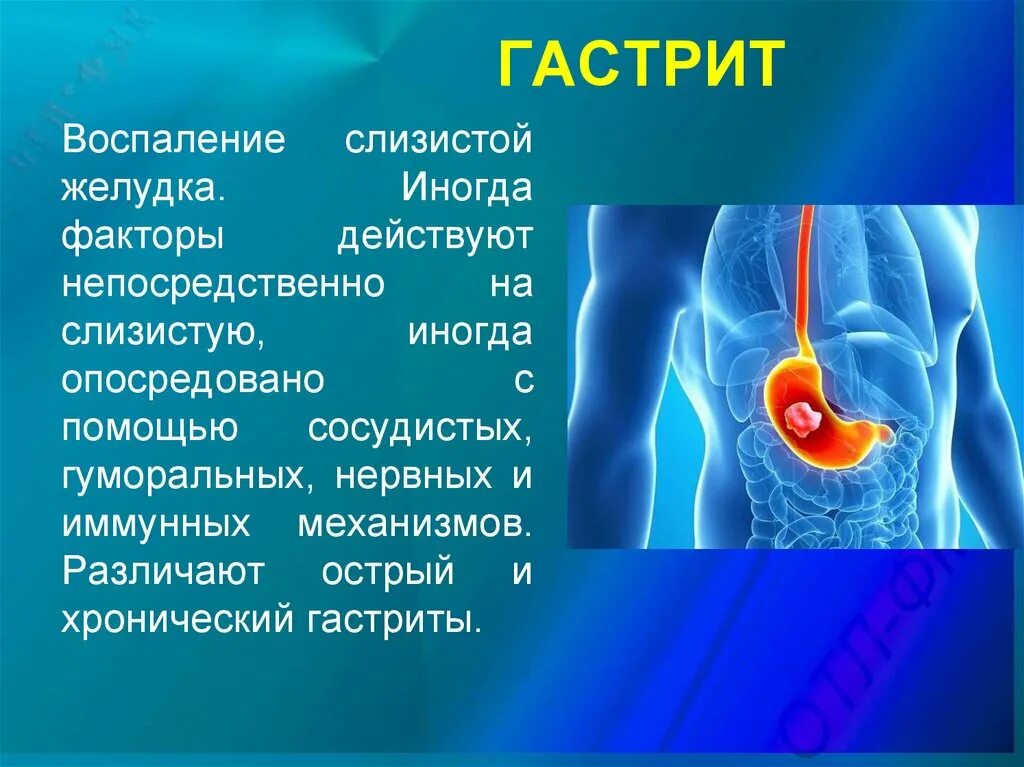 Воспаления слизистой кроссворд. Воспаление слизистой желудка. Гастрит воспаление желудка. Воспаление слизистой желудка и кишечника.