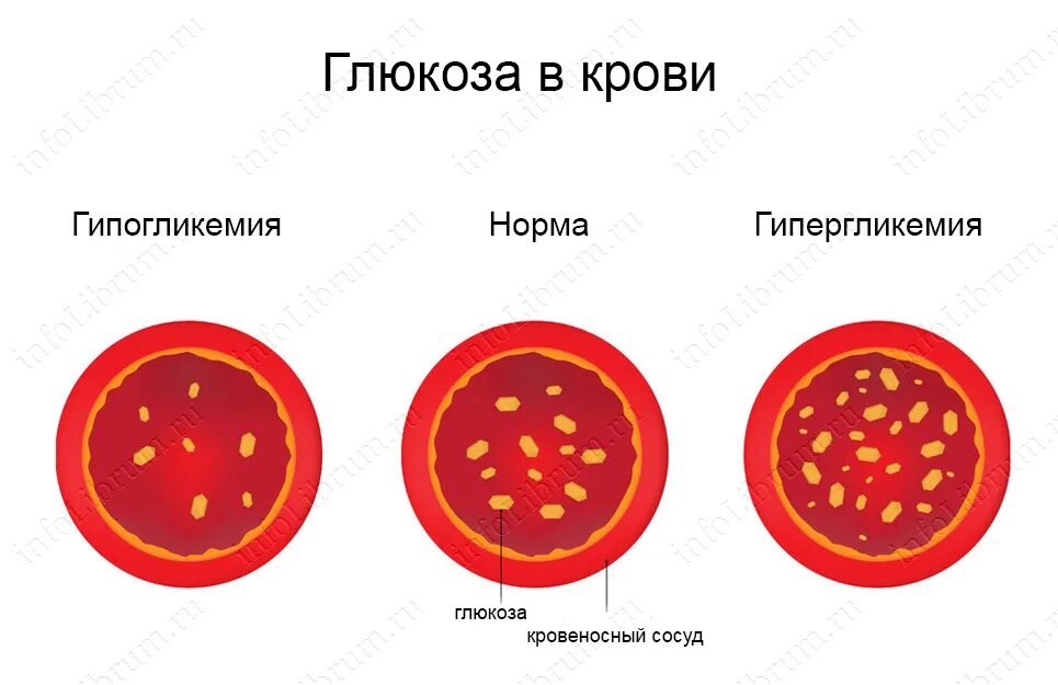 Повышена норма глюкозы в крови. Глюкоза в крови. Сахар в крови норма. Глюкоза в крови повышен. Норма сахара в крови картинки.