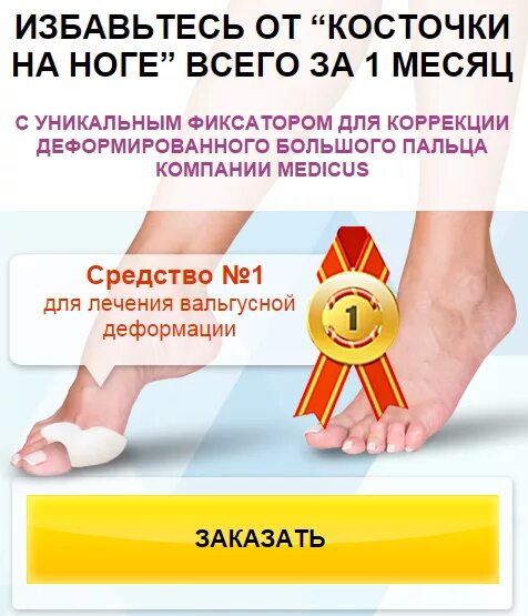 Исправление косточки на ноге. Мазь для ног от косточки на ноге. Костяшка на ноге у большого пальца. Штука от косточки на ноге. Чем лечить косточки на пальцах рук.