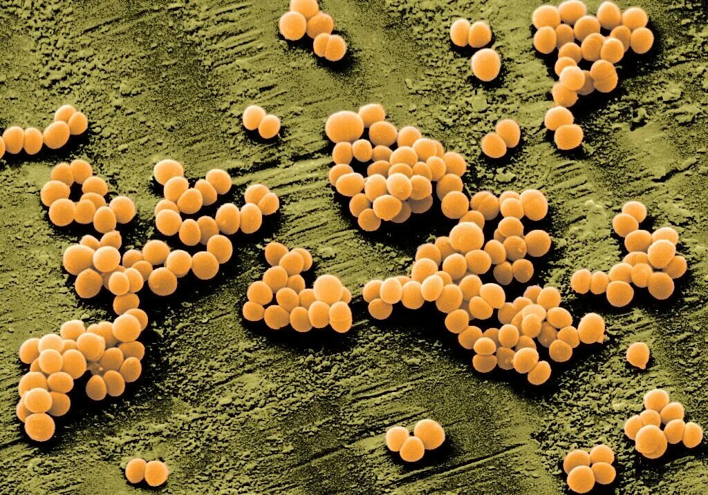 Золотистая инфекция. S. aureus золотистый стафилококк. Стафилококк золотистый Staphylococcus aureus. Метициллинрезистый золотистый стафилококк. Метициллин-резистентный золотистый стафилококк.