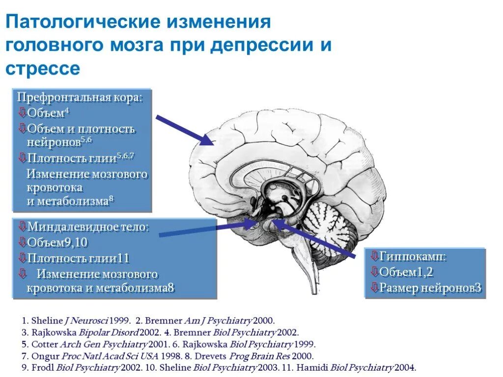 Нарушение развития головного мозга. Изменение структуры мозга. Патологические изменения головного мозга. Изменения в мозге при депрессии. Процессы которые происходят в головном мозге.