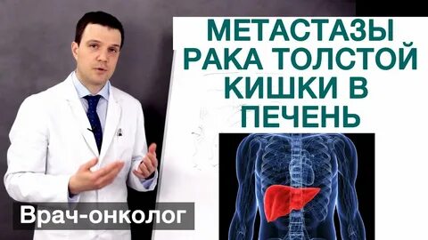 Рак прямой кишки с метастазами