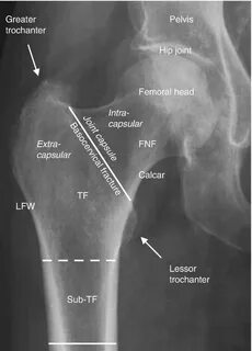 Где x ray