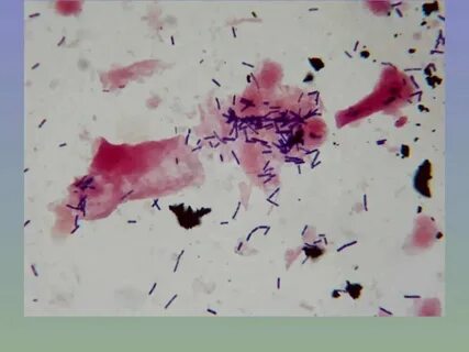 Enterobacteriaceae норма в мазке