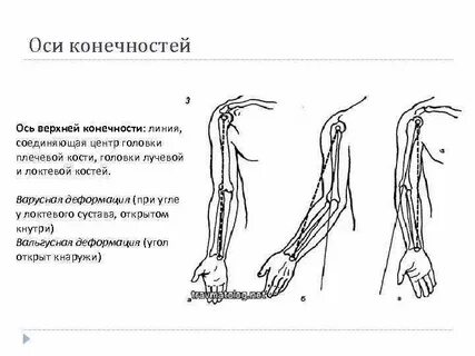 Травматология нижней конечности